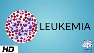 LEUKEMIA, Causes, Signs and Symptoms, Diagnosis and Treatment.