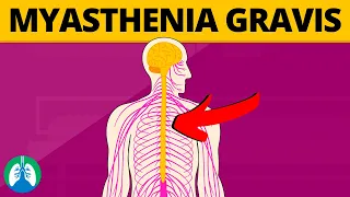 Myasthenia Gravis (Medical Definition)  Quick Explainer Video