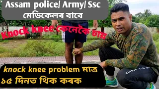 Knock Knee Correction Exercise in assamese,,, Assam police,Army, Ssc gd