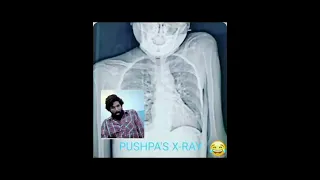 PushpaRaj...xray vision