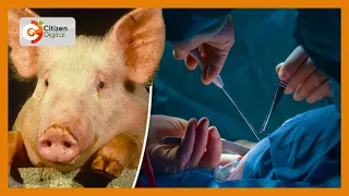 Man gets genetically-modified pig heart in a world-first transplant