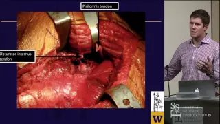 Kocher Langenbeck Approach for Acetabular Fractures - Michael Githens, MD