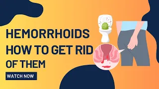 🔴How To Get RID Of HEMORRHOIDS.