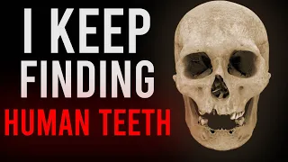 I Keep Finding Human Teeth | Horror Story | Creepypasta