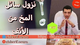 سيلان السائل المخي النخاعي من الأنف | د أحمد الشريف #177