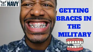 How to get Braces in the Military