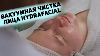 Чистое лицо за полчаса! Вакуумная чистка лица HydraFacial