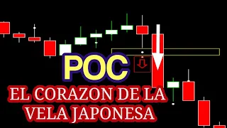 🔴El Punto POC en la Vela Japonesa Cambiara Para Siempre Tu Trading