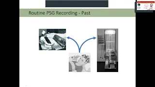 Basics of Polysomnography Implications for Sleep Physiology and Sleep