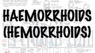 Haemorrhoids (Hemorrhoids) - Overview (pathophysiology, investigations and treatment)