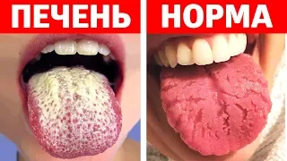 ЕСЛИ ТВОЙ ЯЗЫК ВЫГЛЯДИТ ТАК, БЕГИ К ДОКТОРУ!