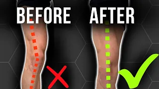 Unf*ck Your Knee with These 2 Drills | Fix Inner and Outer Knee Pain