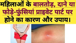 (बालतोड़ या दाने ) Boils in the private parts Area female / causes and Treatment for Pimples/Boils.