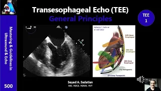 Transesophageal Echo (TEE)1- General Principles