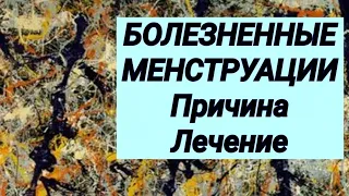 Болезненные менструации 😢 Причина и лечение 💊 Клинический случай ☝️