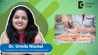 CLOGGED PORES - How to get rid of it?  - Dr. Urmila Nischal | Doctors' Circle