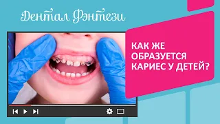 Как же образуется кариес у детей❓😱