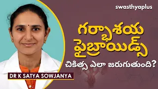 గర్భాశయ ఫైబ్రాయిడ్స్ : చికిత్స ఎలా జరుగుతుంది? | Uterine Fibroids in Telugu | Dr K Satya Sowjanya