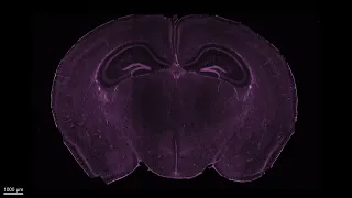 Mouse brain cleared with CUBIC