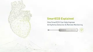 SmartECG Explained: How SmartECG Can Help Improve Arrhythmia Detection