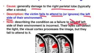 Spatial Neglect - VCE Psychology