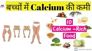 बच्चों में Calcium की कमी कैसे दूर करें || 10 Calcium -Rich Food || Calcium Deficiency in Babies