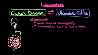 Inflammatory bowel disease: Diagnosis | Gastrointestinal system diseases | NCLEX-RN | Khan Academy