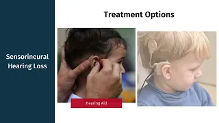 Introduction to Hearing Loss