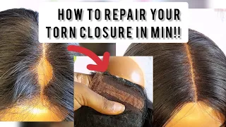 😳How to fix your torn closure wig at home! #diy #closure #hacks #wigtutorial #sensationnelhair