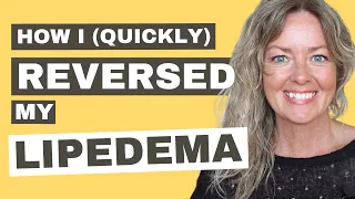 How I Reversed My Lipedema in Just a Few Months