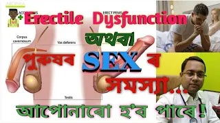 What is Erectile Dysfunction (in Assamese), Causes, Symptoms | Impotence| Male Sexual Dysfunction |