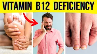 Symptoms of Vitamin B12 Deficiency You Should Never Ignore