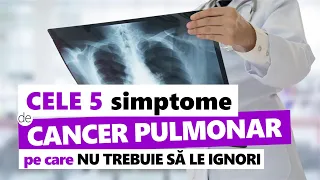 5 Simptome de Cancer Pulmonar pe Care NU Trebuie să le Ignori