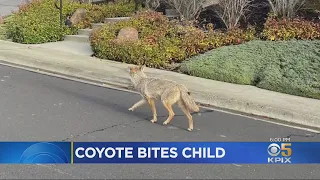 Coyote Attacks, Bites Child Walking With Mother In Moraga Neighborhood