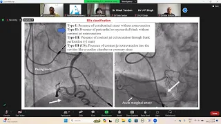 Echo Webinar 4th Feb,2024: Rare Case Studies