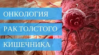 РАК ТОЛСТОГО КИШЕЧНИКА - лечение без операции!