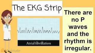 What is Atrial Fibrillation also known as A fib