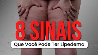 Saiba Quais os 8 Sinais que Indicam Lipedema. Saúde das suas pernas