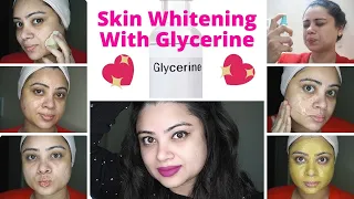 Use Glycerin This Way Your Skin Will Look So Young, Tight, Spotless & Scar Free! | Fair Skin |