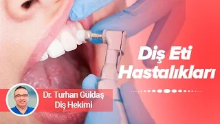 Dr. Turhan Güldaş - Diş Eti Hastalıkları ve Tedavi Şekilleri