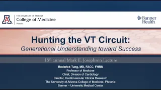 Hunting the VT Circuit by Dr. Roderick Tung