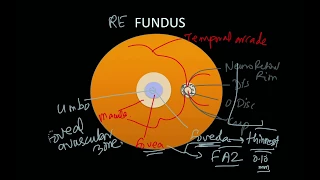 High Yield Topic - Clinical Anatomy of Retina