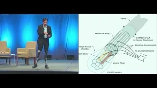 CHI 2012 Closing Keynote: Hugh Herr - Designing Intelligent Orthotics and Prosthetics