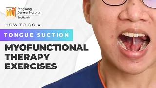 Do this to STOP SNORING and prevent SLEEP APNEA! Tongue Suction - Myofunctional Therapy | 3 of 5