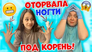 Ксюша СЛОМАЛА под КОРЕНЬ XXL Ногти😱👉 Лера СПАСАЕТ