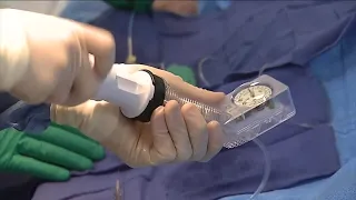 Cleveland Clinic adopts new heart attack treatment protocols