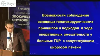 Н.Е. КУДАШКИН, Хирургическое лечение гепатоцеллюлярного рака на фоне цирроза печени.