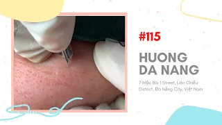 #115 | Huong Da Nang