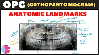 Orthopantomogram (OPG) Anatomical Landmarks / Panoramic Radiography landmarks - Radiology