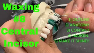 Waxing Tooth #8 Central Incisor..... Dental School | Pre-Dental | INBDE | Dental Anatomy | Wax